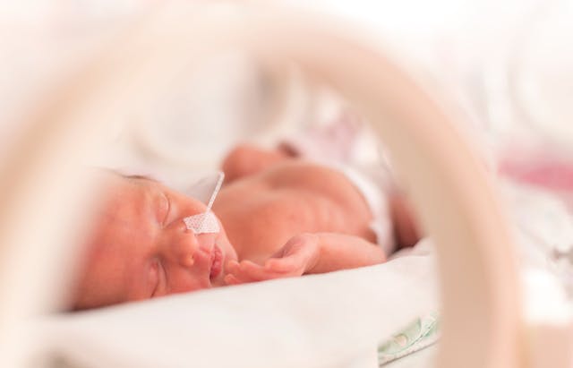 Evaluating second-stage cesarean delivery’s link to preterm birth | Image Credit: © ondrooo - © ondrooo - stock.adobe.com.