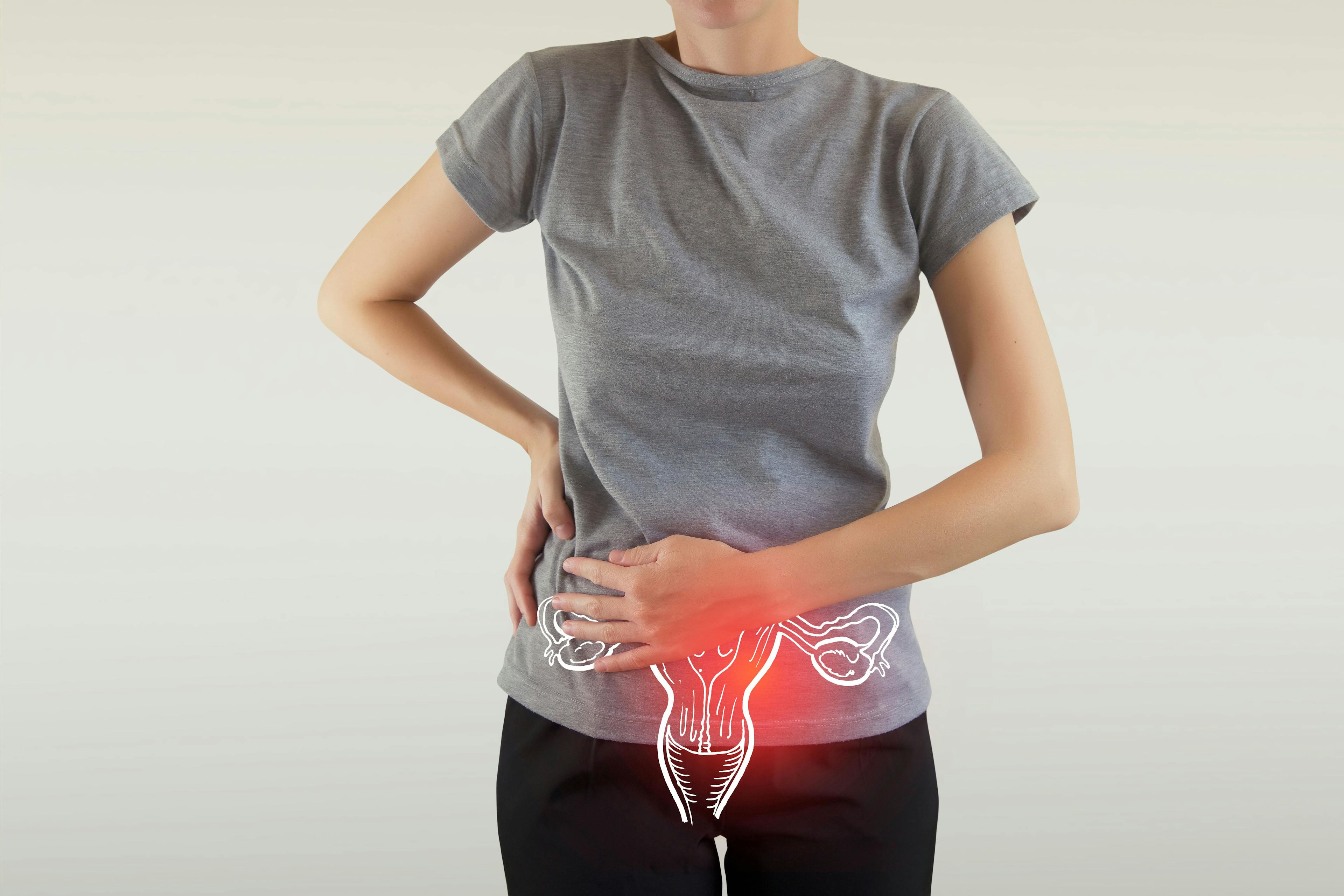 Radical hysterectomy improves survivability from cervical cancer | Image Credit: © mi_viri - © mi_viri - stock.adobe.com.