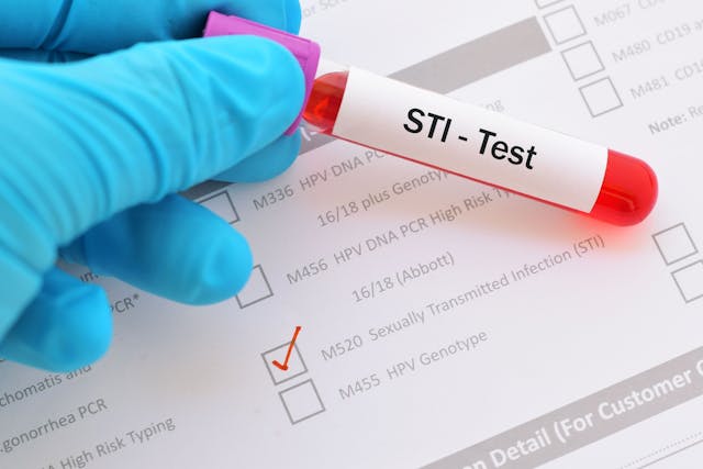 Evaluating GeneXpert point-of-care testing for STIs | Image Credit: © jarun011 - © jarun011 - stock.adobe.com.