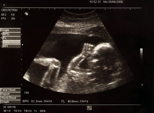 ultrasound image | Image Credit: ©Mikael Damkier / Adobe Stock