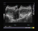 DailyDx: Test Your Ultrasound Skills