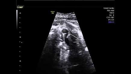 Image IQ: The Fetal Chest
