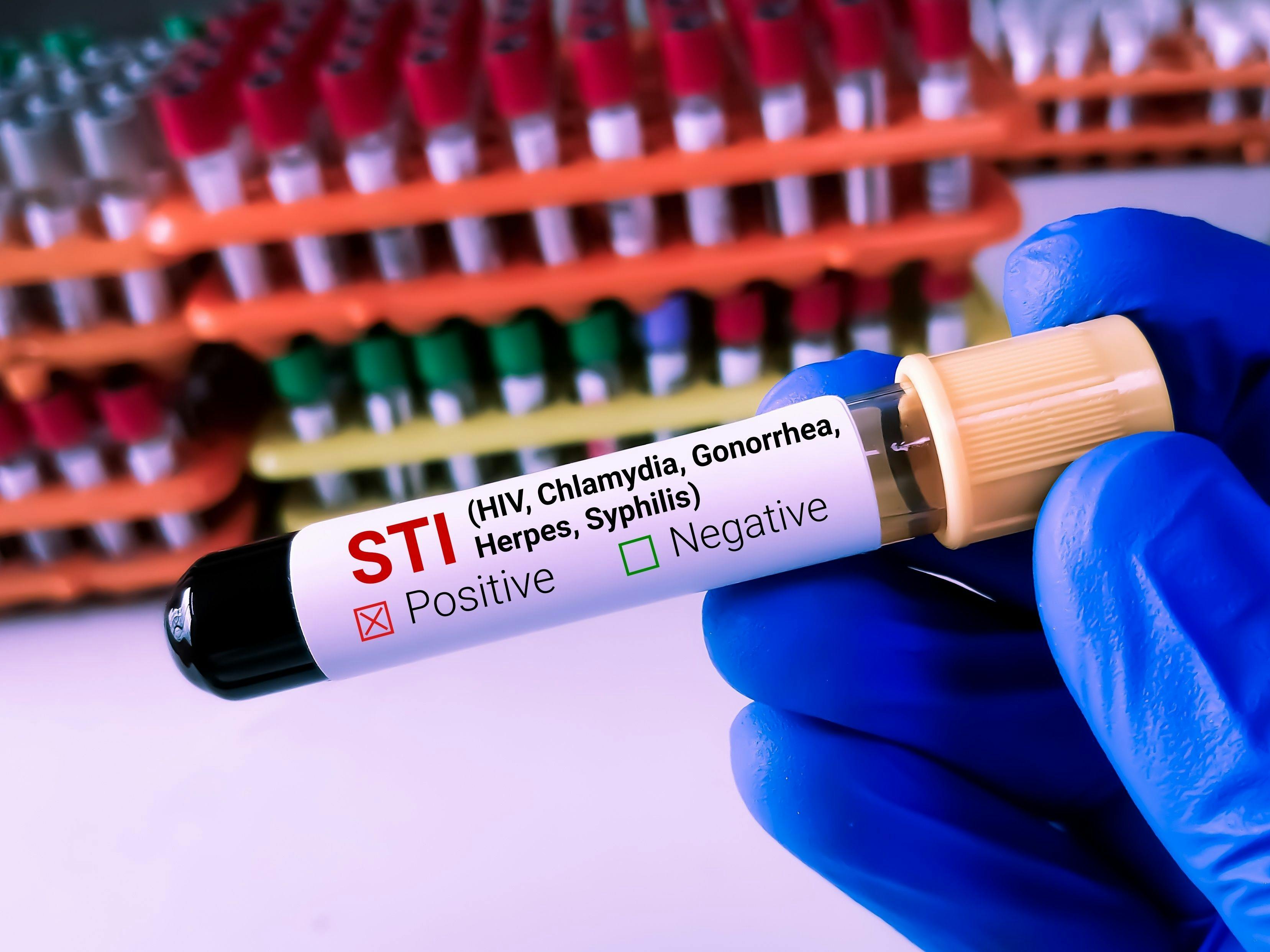 Image Credit: Should more adolescents get tested for STIs in pediatric emergency departments? © Saiful52 - ©  stock.adobe.com.