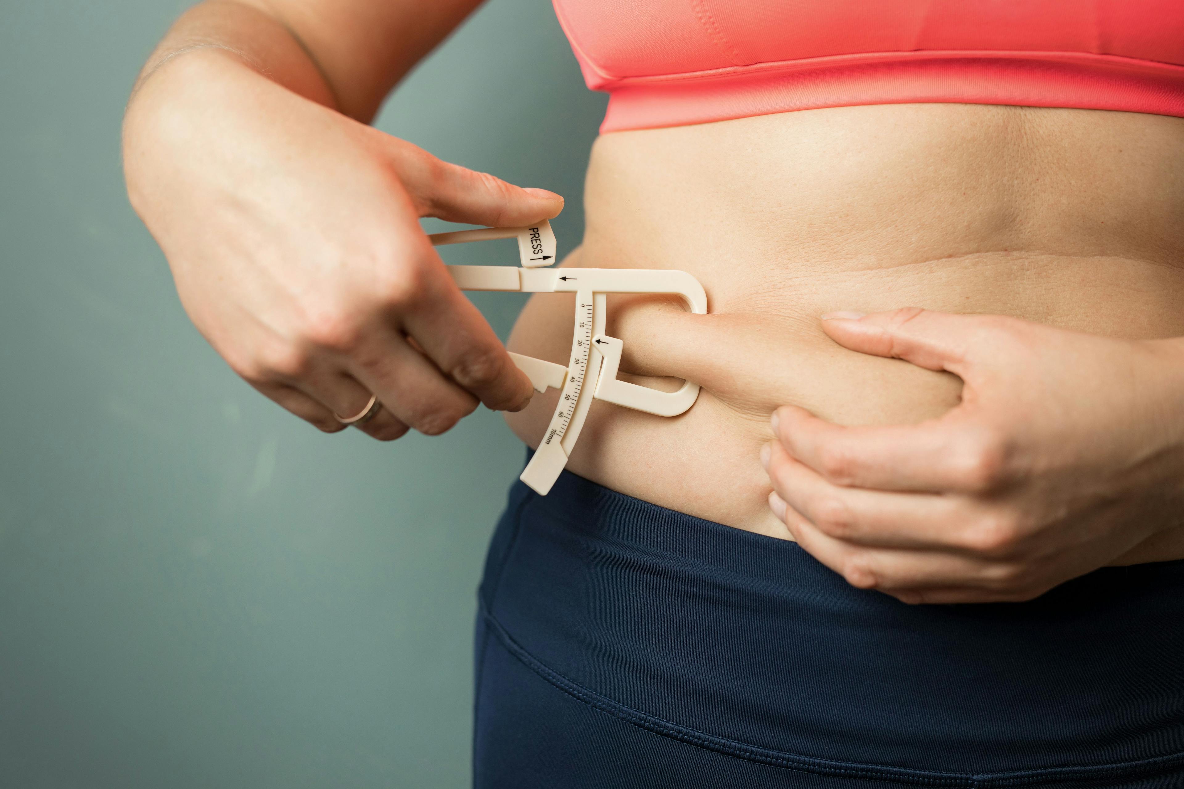 Is body fat linked to endometriosis?