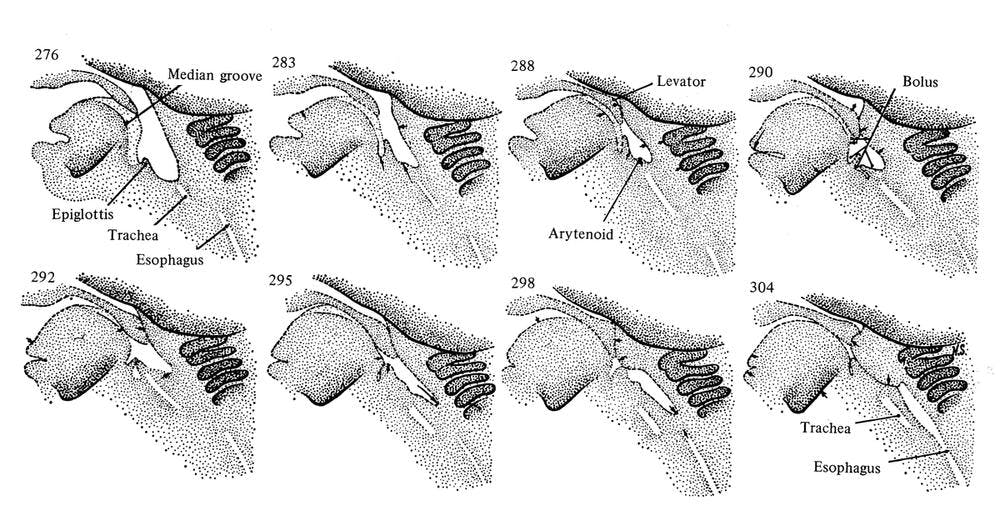 Figure 2. Sequential images from cineradiological recordings showing the movement of the pharyngeal/laryngeal structures during newborn infant swallowing. Used with permission from Bosma et al. (1966).11 Note that in these images the epiglottis is shown to partially cover the entrance to the larynx as it does in adults, and not to interlock with the soft palate.