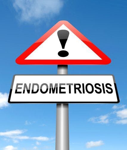 Two New Drugs Show Promise for Endometriosis