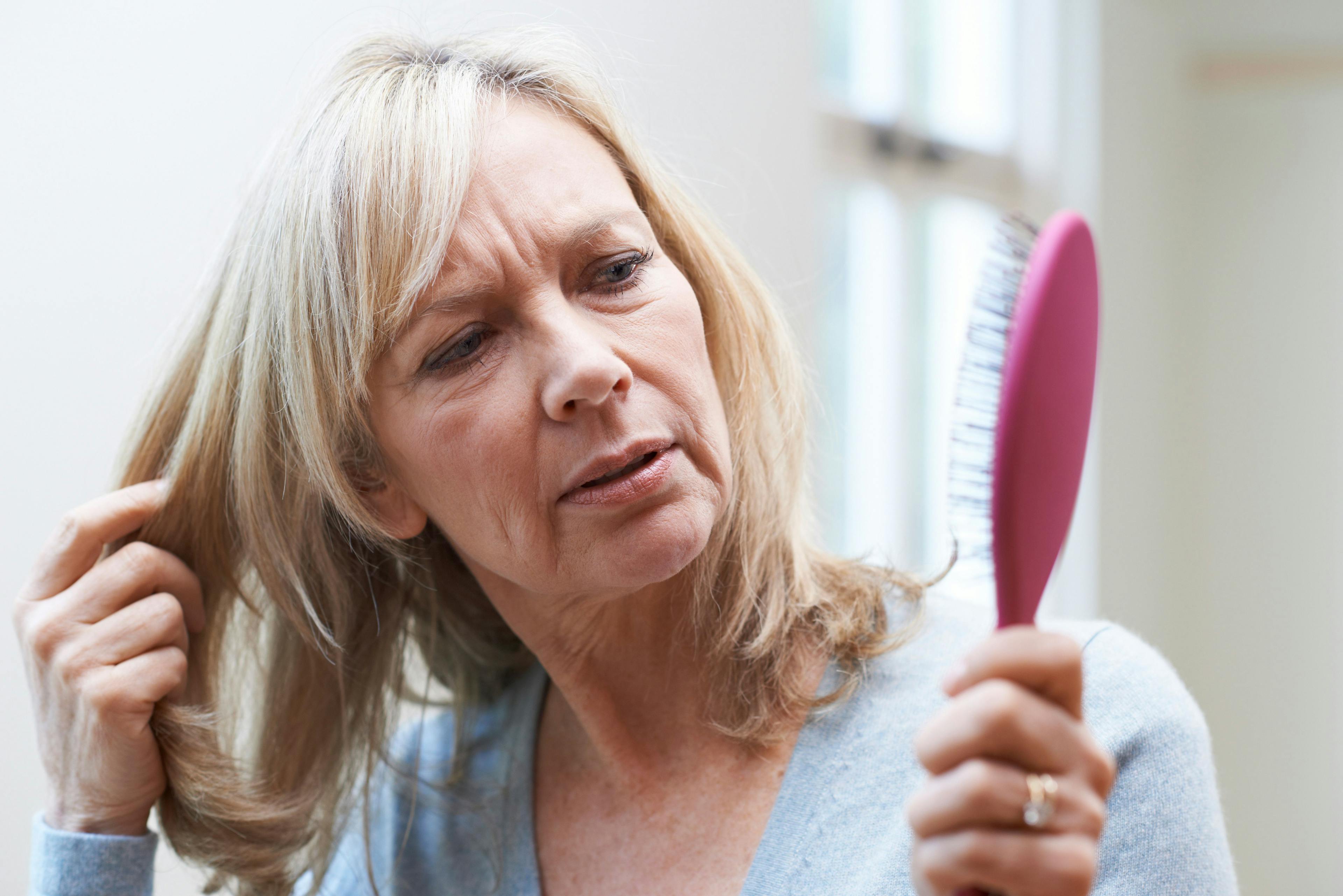 Study shows strong correlation between female pattern hair loss and BMI in postmenopausal women