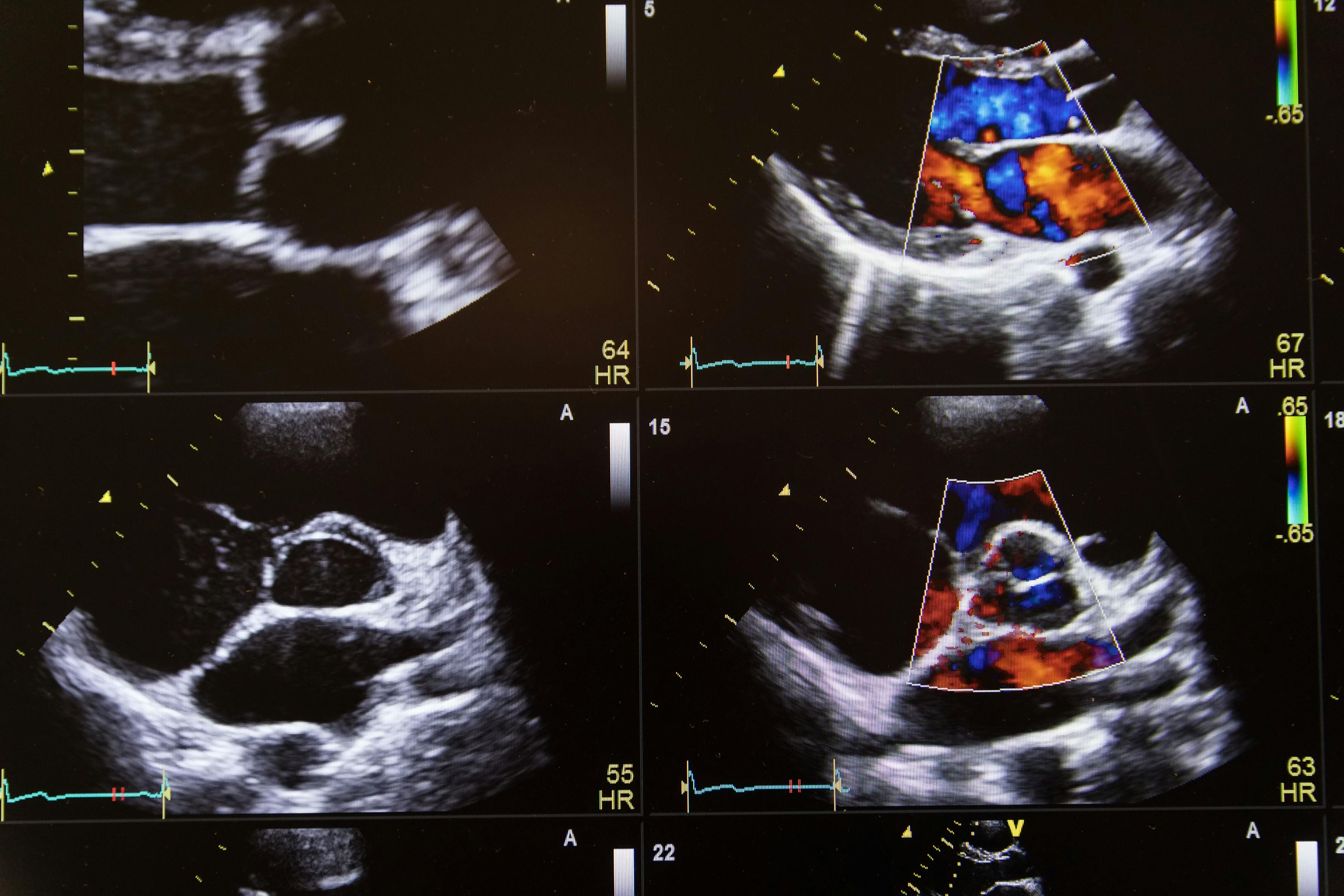 Do you need to review the images of an ultrasound study?