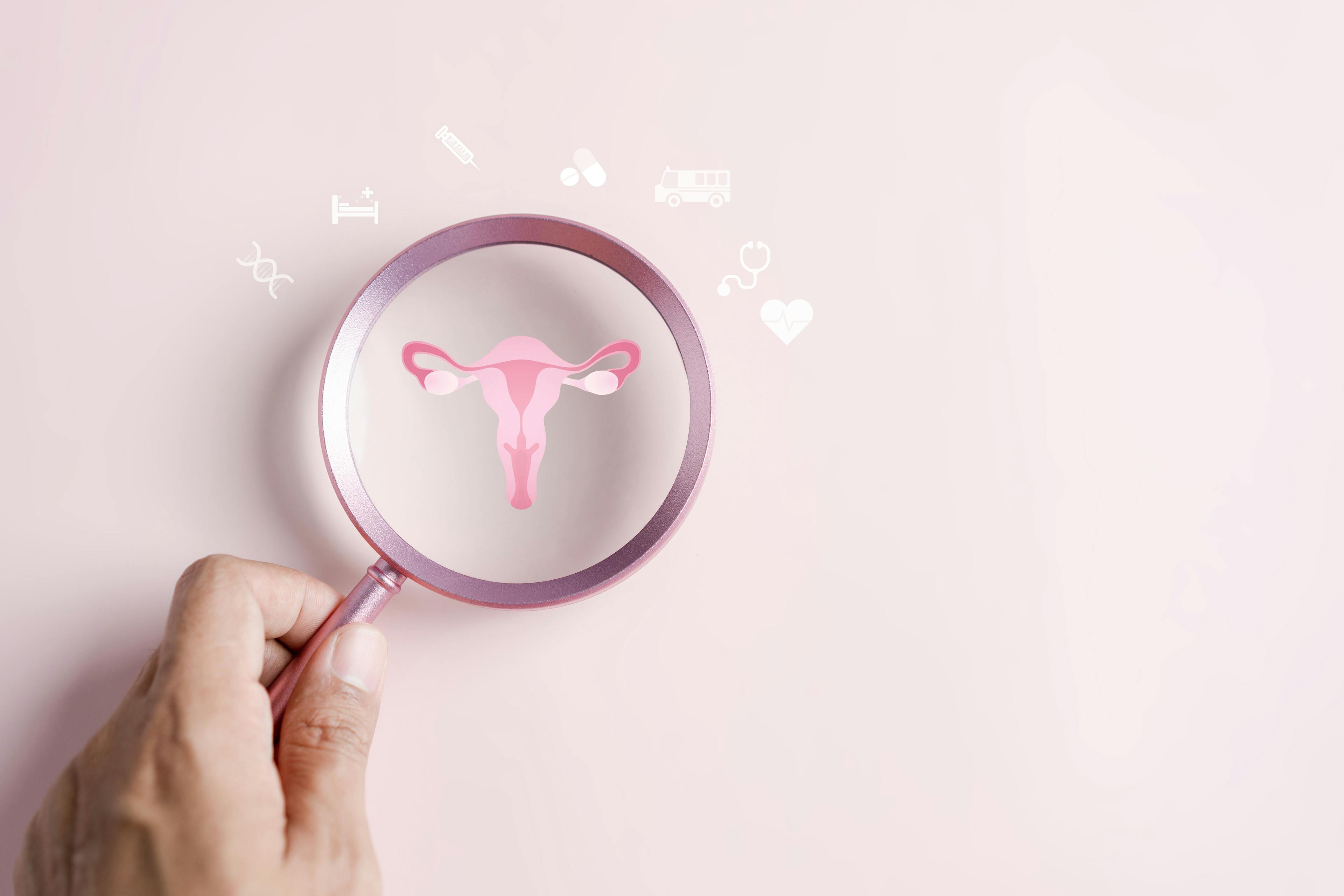 Understanding endometriosis: Impact on women's health, symptoms | Image Credit: © Kiattisak - © Kiattisak - stock.adobe.com.