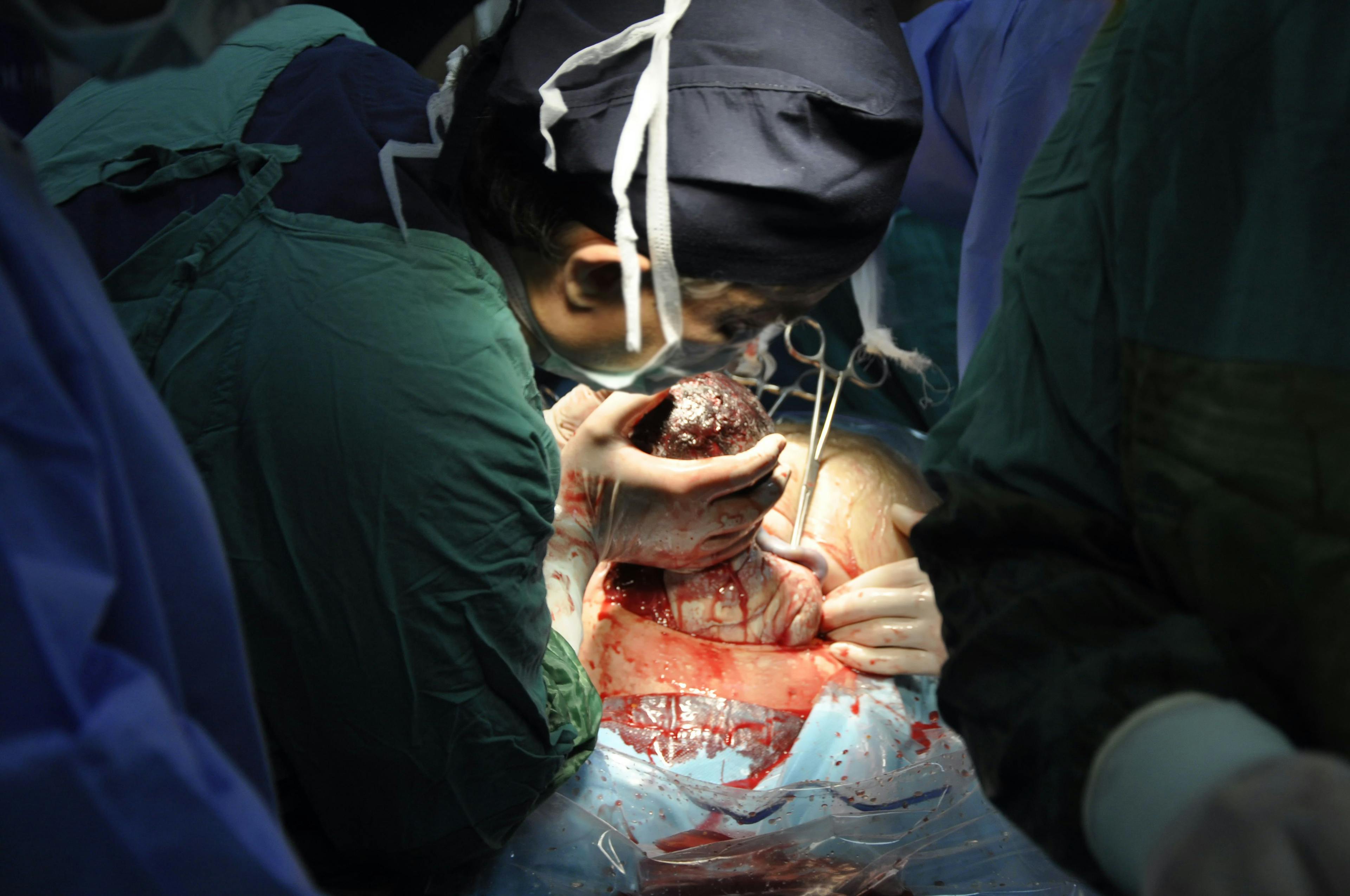 Enhanced Recovery After Cesarean Section