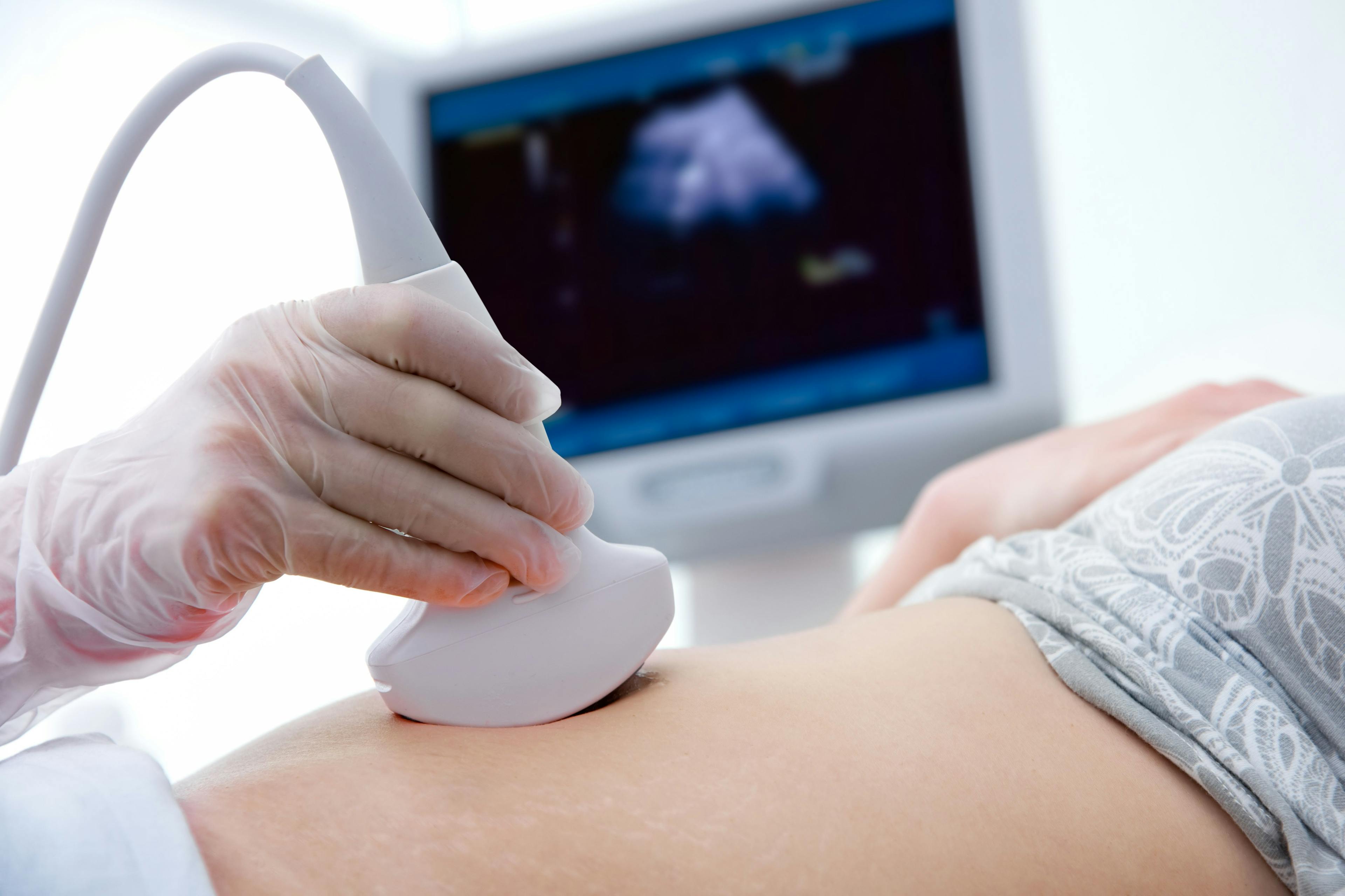 Sonographic abnormalities in pregnancies after IVF