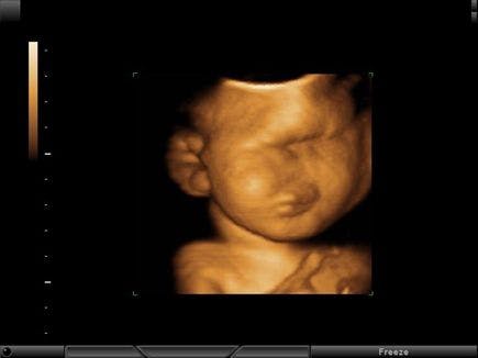 Image IQ: The Fetal Face and Brain