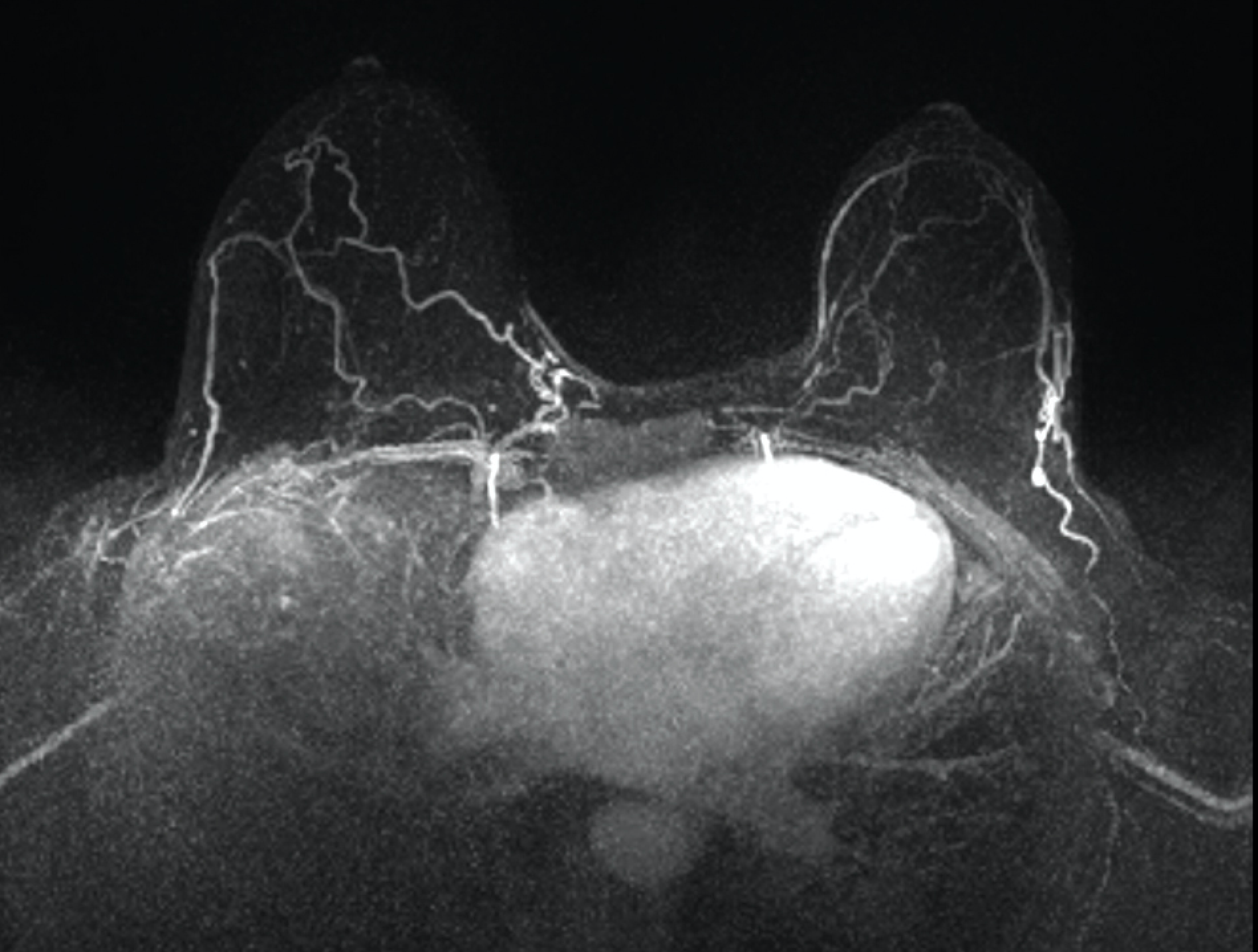 Gadolinium-based contrast in breast MRI: What ob/gyns need to know