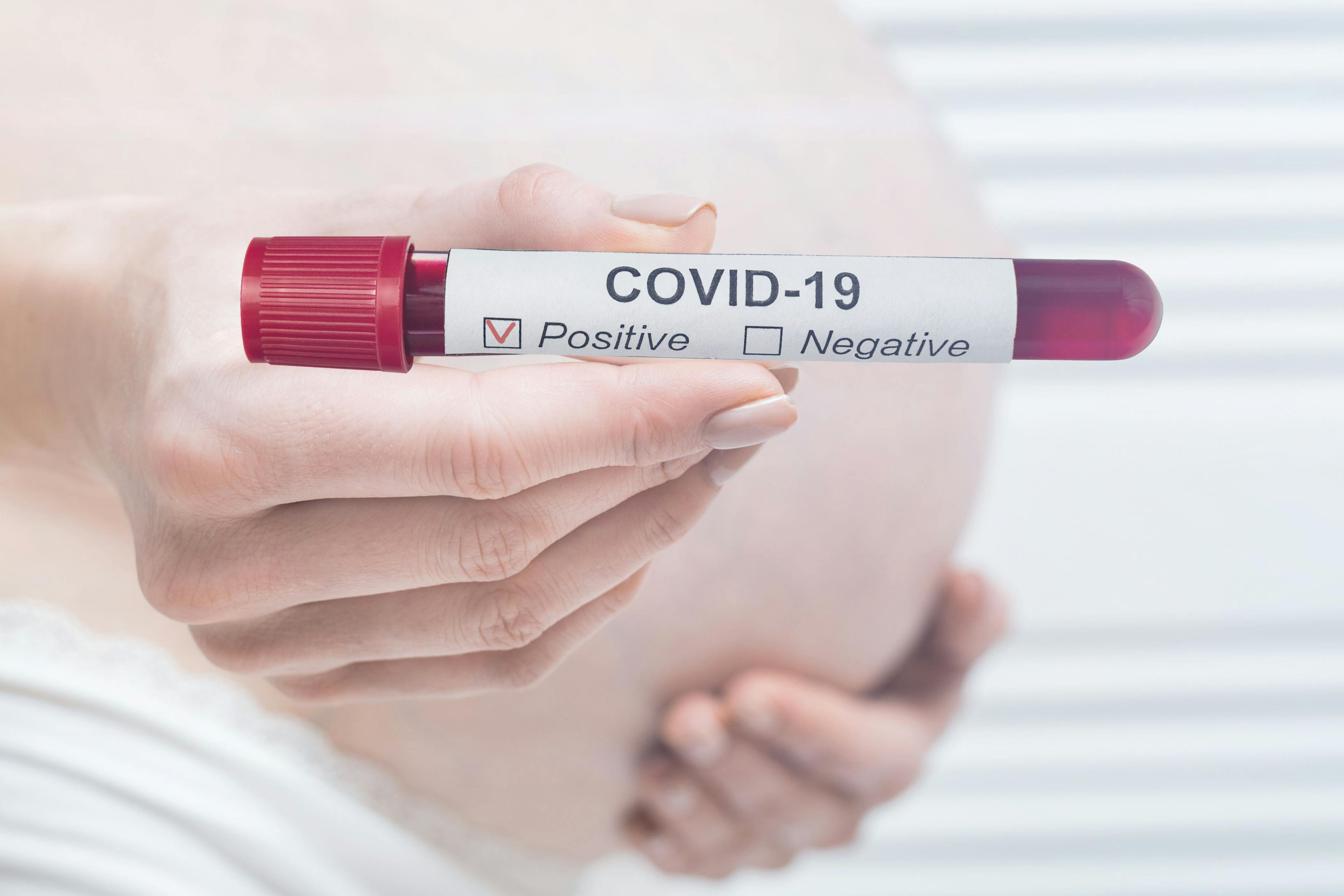 Severity of COVID-19 Determines Likelihood of Pregnancy Complications