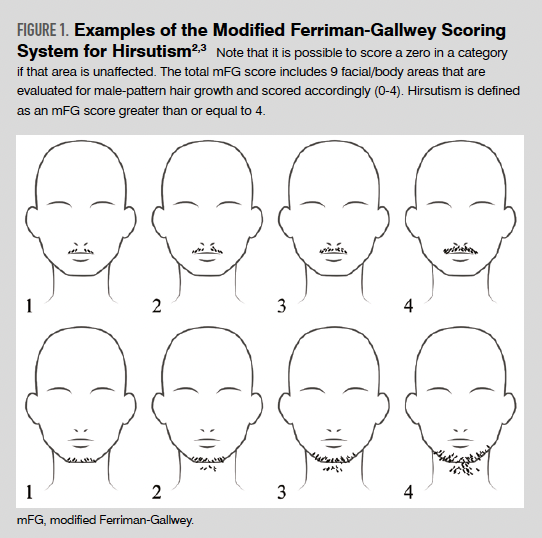 Examples of the Modified Ferriman-Gallwey Scoring System for Hirsutism