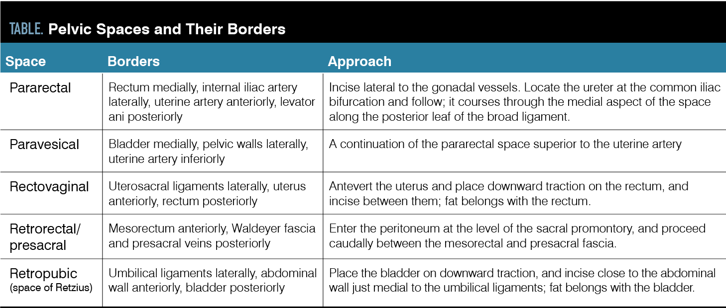 TABLE. Pelvic Spaces and Their Borders