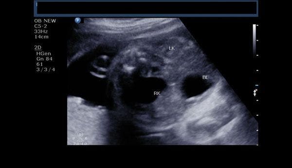 Daily Dx: 34-Week Old Fetus