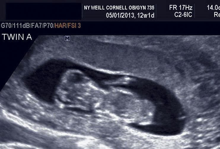 Ultrasounds images: Fetal anomalies of the first and second trimesters (Part 1)