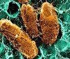 Antibiotic Resistance in UTIs Explained