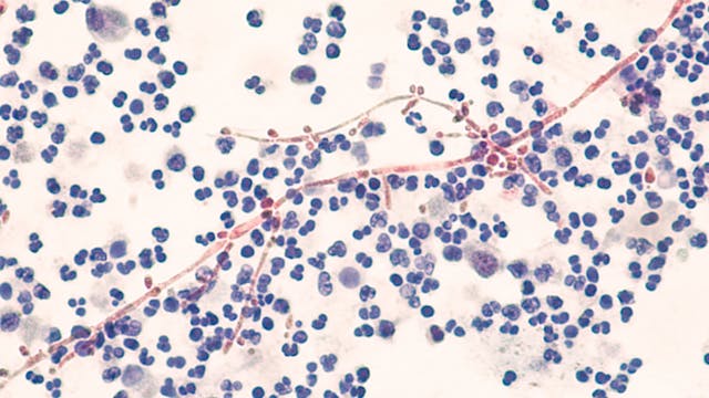 Tetrazole oteseconazole for treating Candida albicans | Image Credit: © David A Litman - © David A Litman - stock.adobe.com.