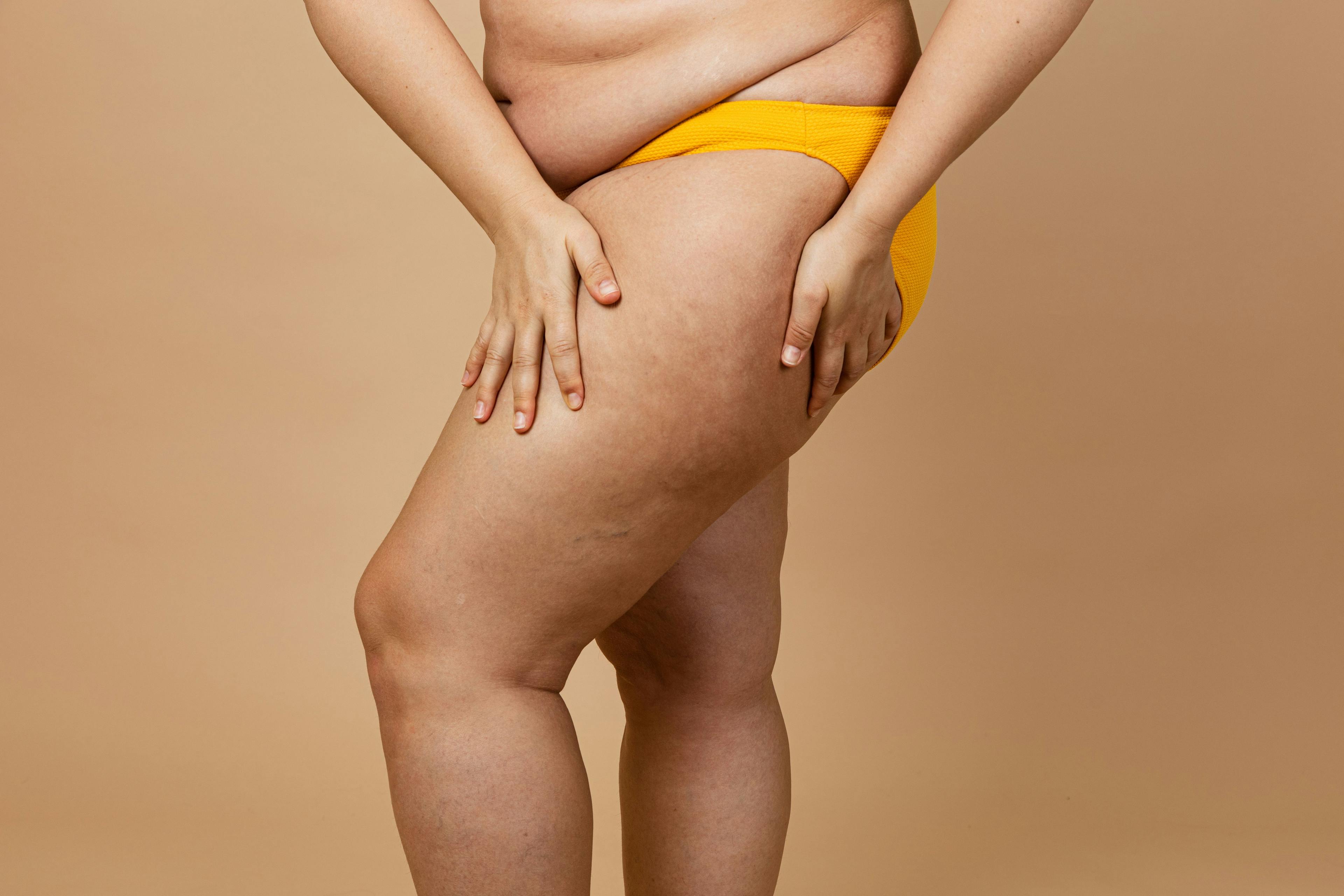 Midlife overweight status linked to higher morbidity 