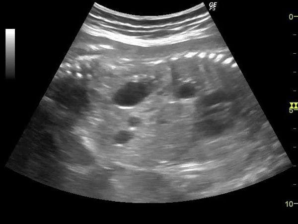 Image IQ: Anomaly in the Fetal Abdomen