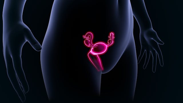 Uterine artery embolization versus myomectomy to treat uterine fibroids