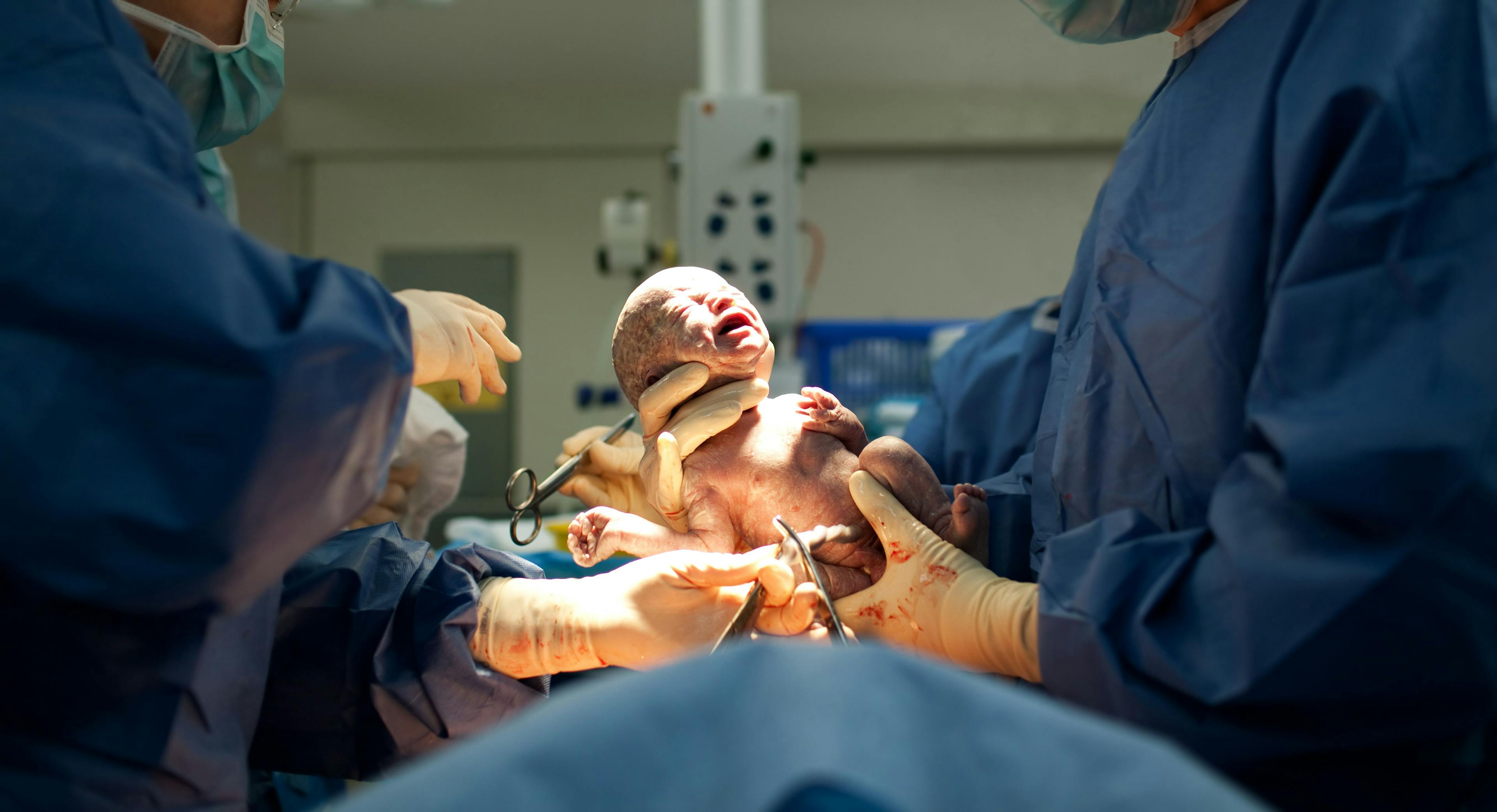 Evidence-based cesarean delivery guidelines