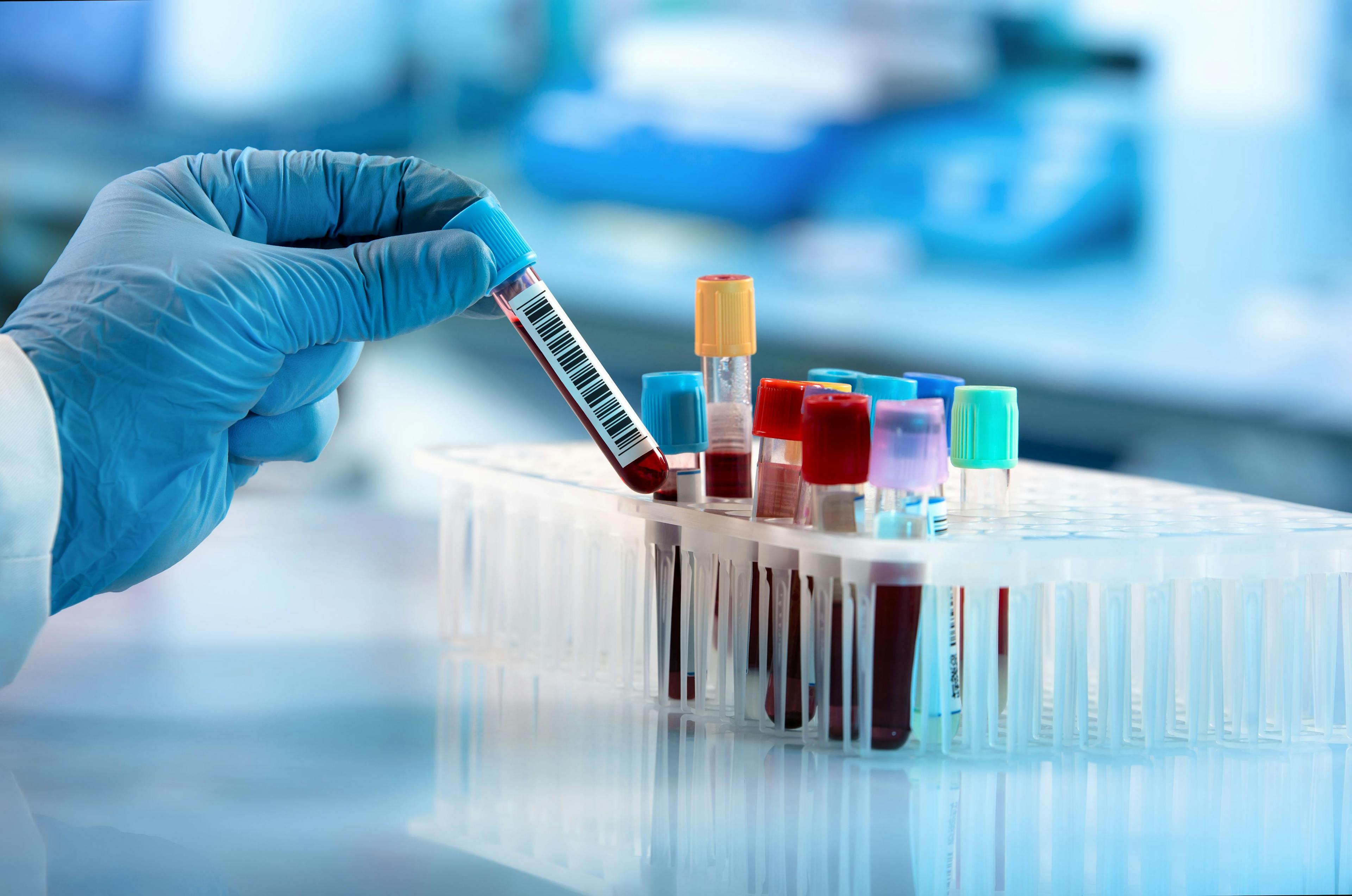 Detecting endometrial cancer with new non-invasive blood test
