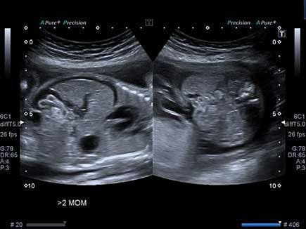 Image IQ: A 24-Week Fetus