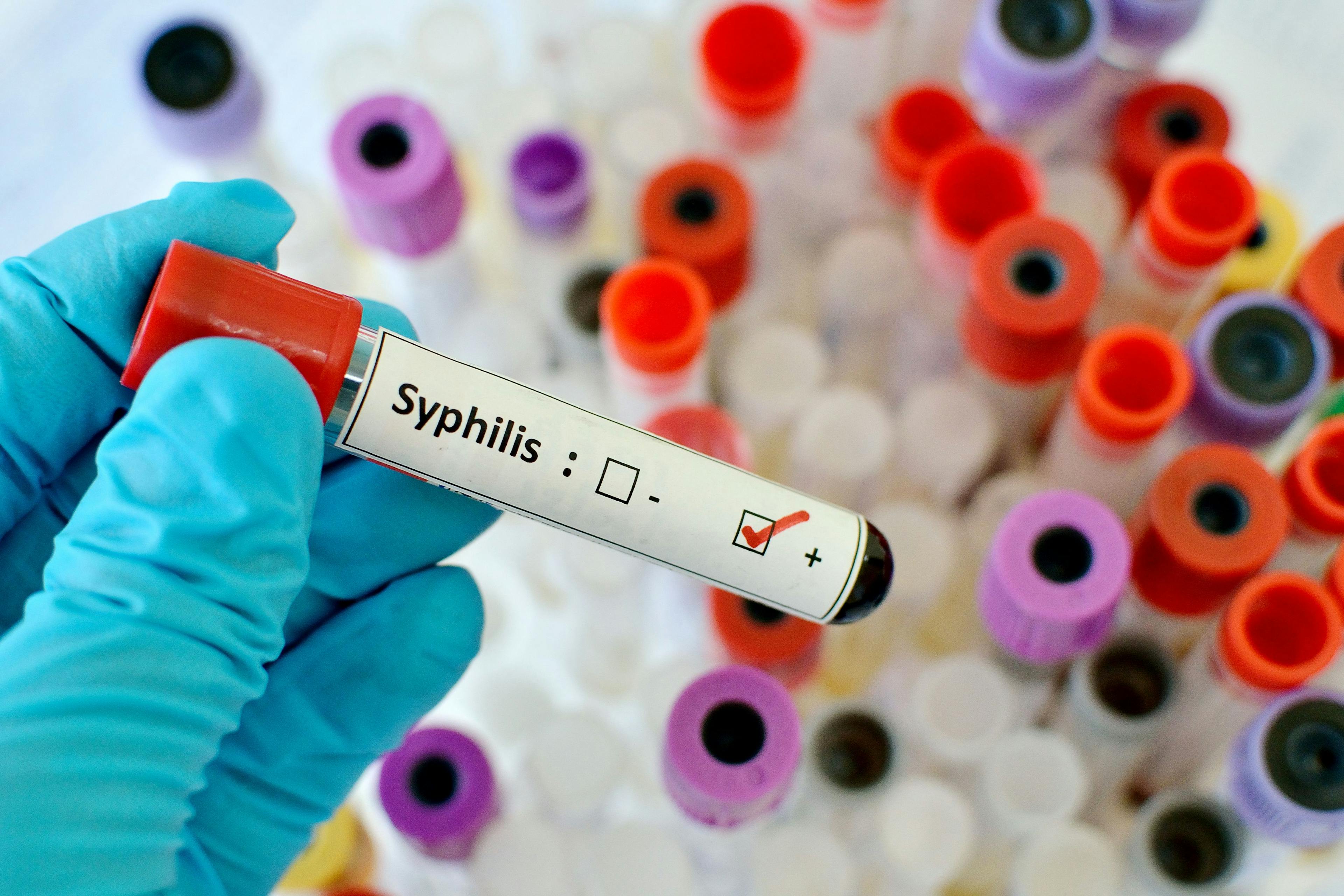 Innovating diagnosis and treatment for congenital syphilis | Image Credit: © jarun011 - © jarun011 - stock.adobe.com.