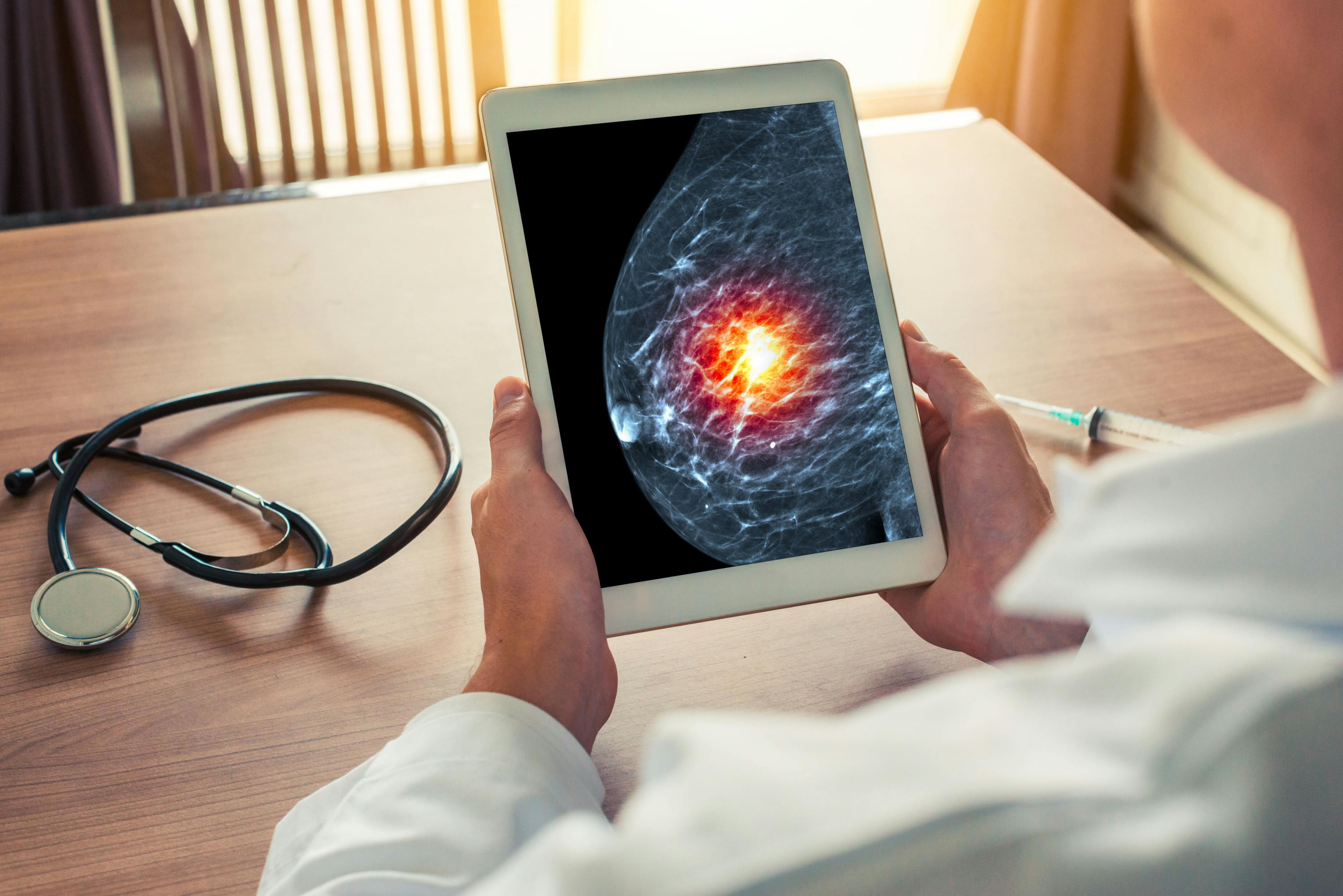 Breast cancer diagnosis during and before pandemic