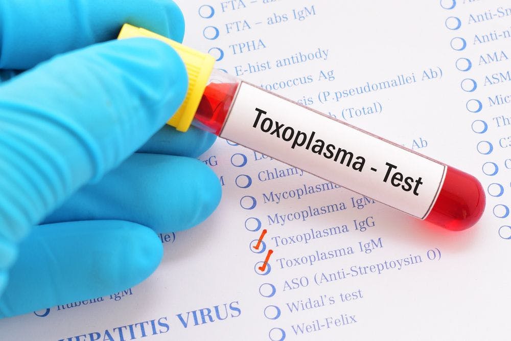 Can this low-cost blood test help prevent toxoplasmosis?