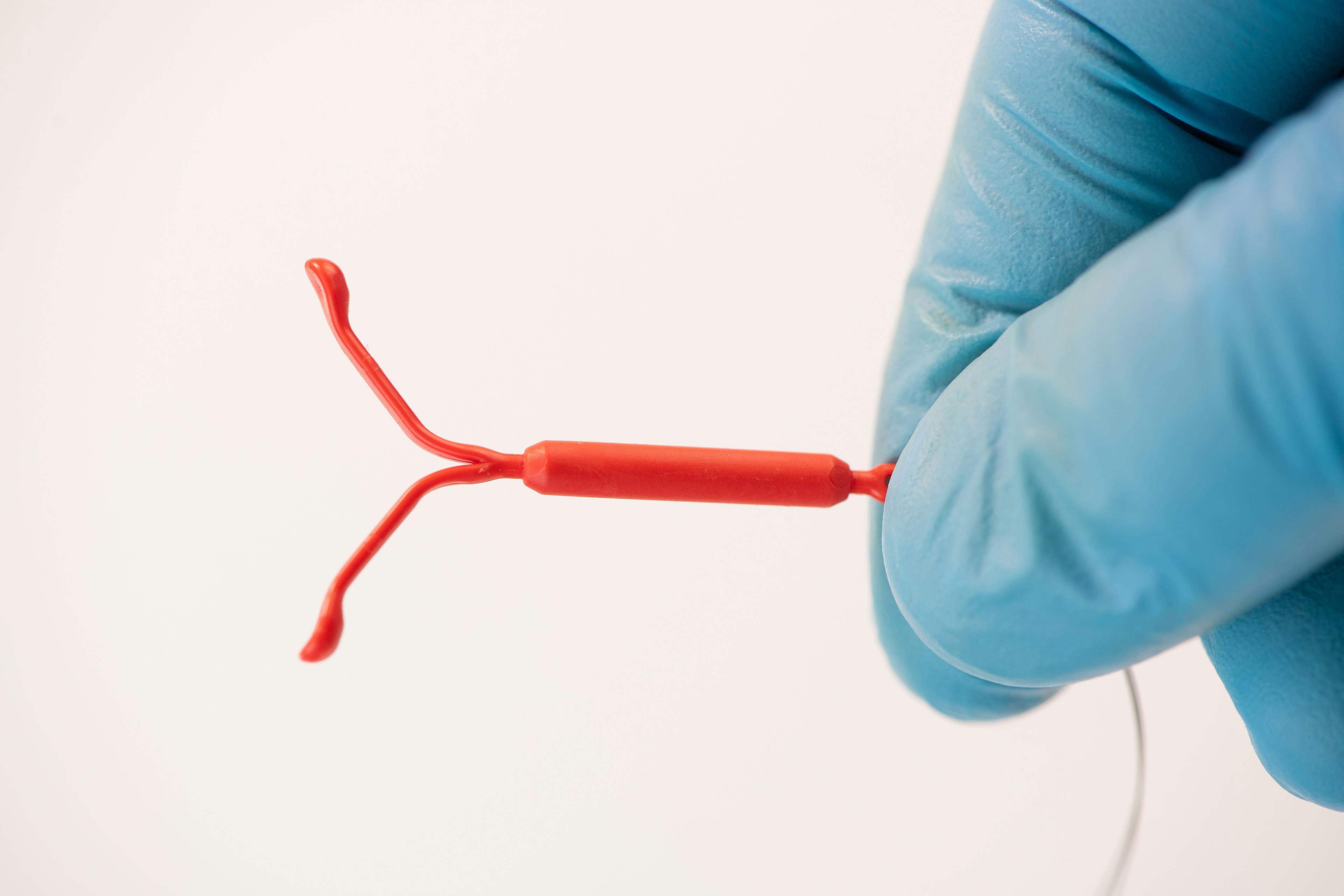 Study finds risk of pregnancy low prior to IUD placement following recent unprotected sex