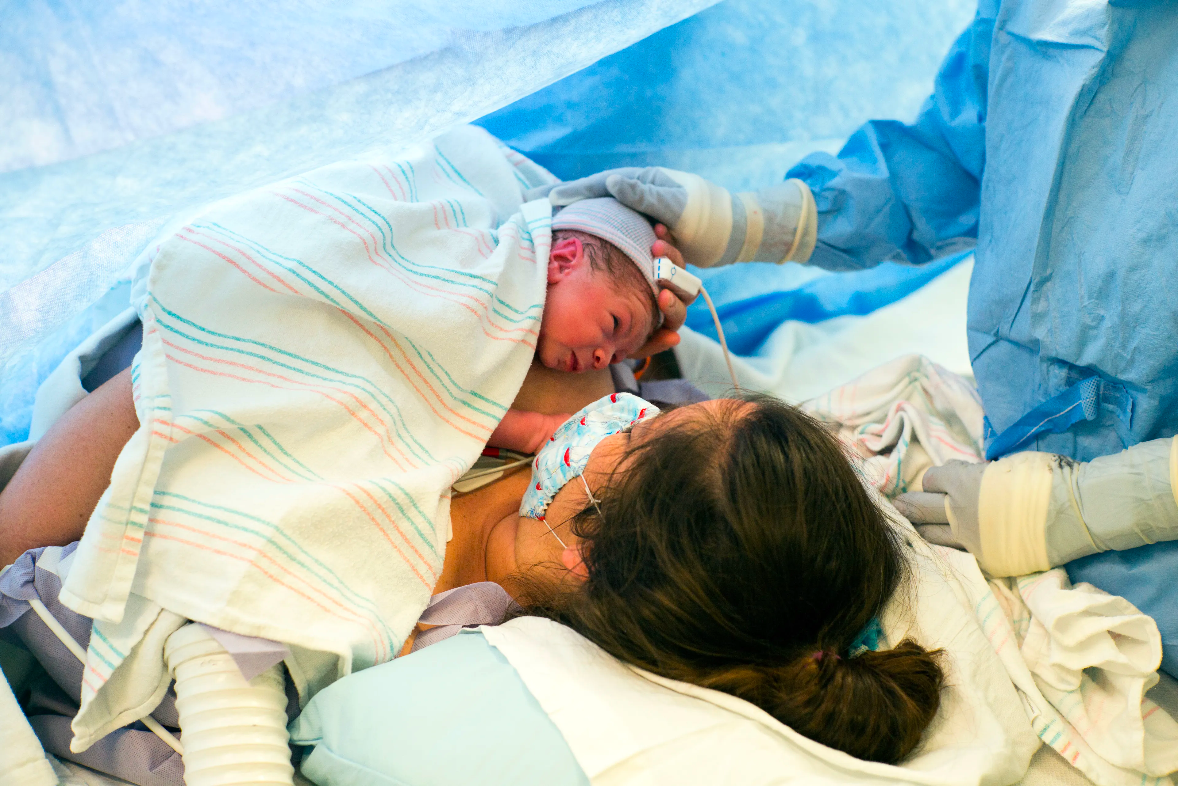 Methods identified to reduce bleeding after cesarean delivery | Image Credit: © Fred Facker - © Fred Facker - stock.adobe.com.