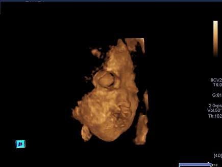 Image IQ: "Incidental" Findings in 3rd Trimester Pregnancy