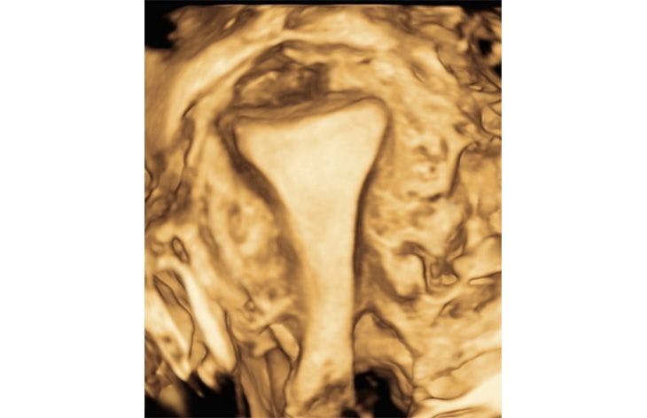 Ultrasound images: Gynecologic diagnoses (Part 2)