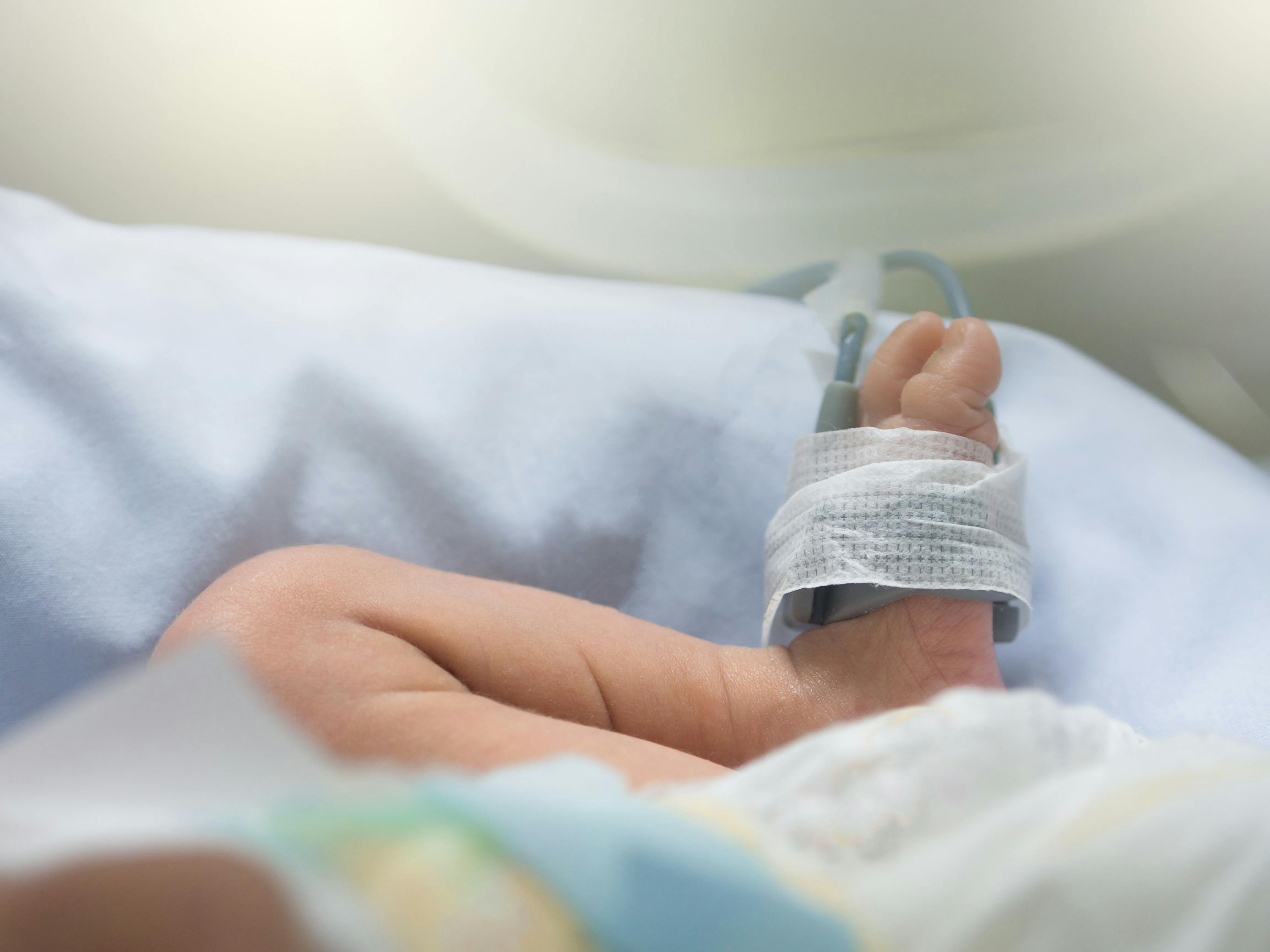 Low birth weight and early hypoxemic respiratory failure impact neurodevelopment and survival