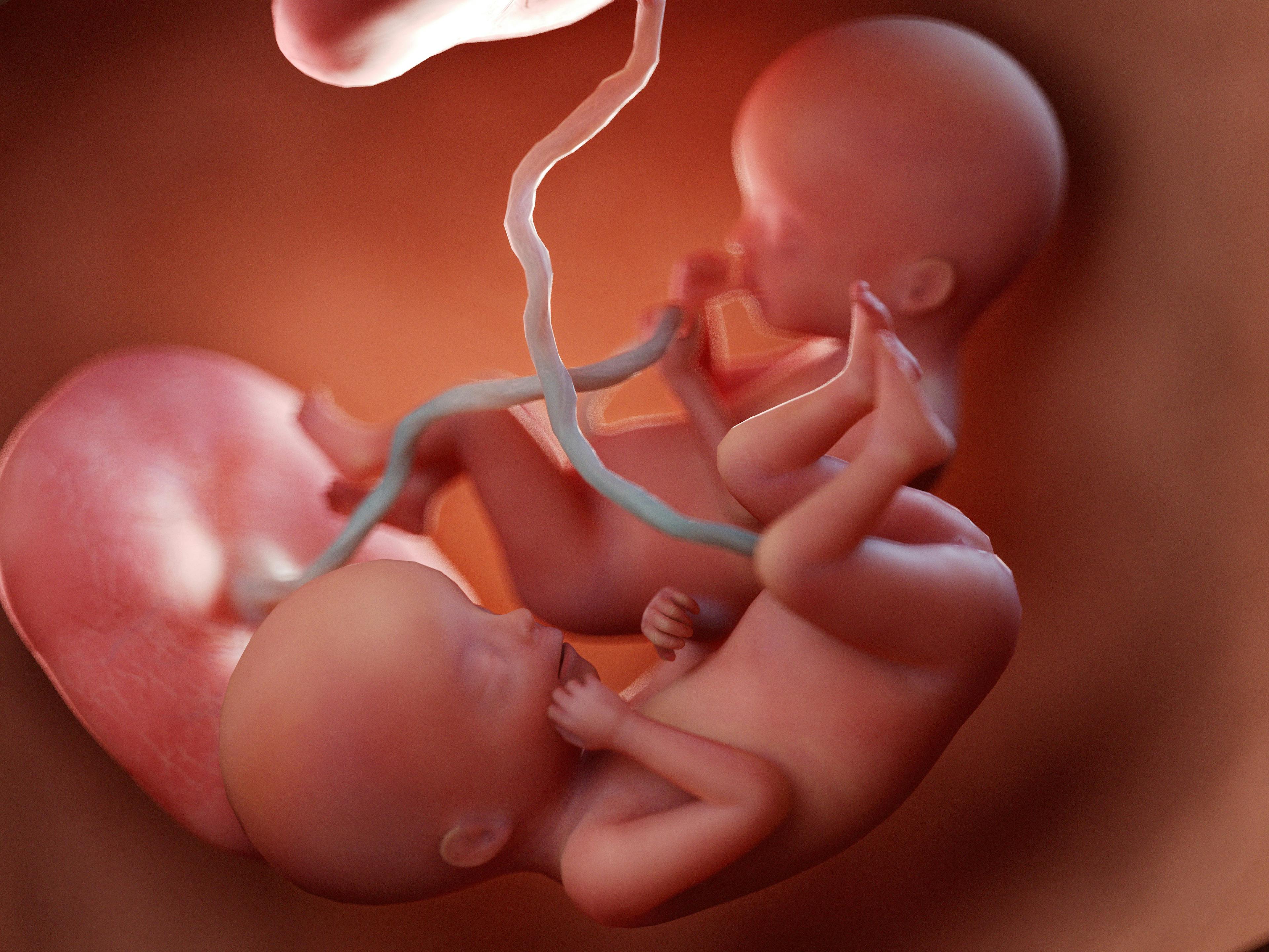 Developmental abnormalities due to fetus and placenta, study finds