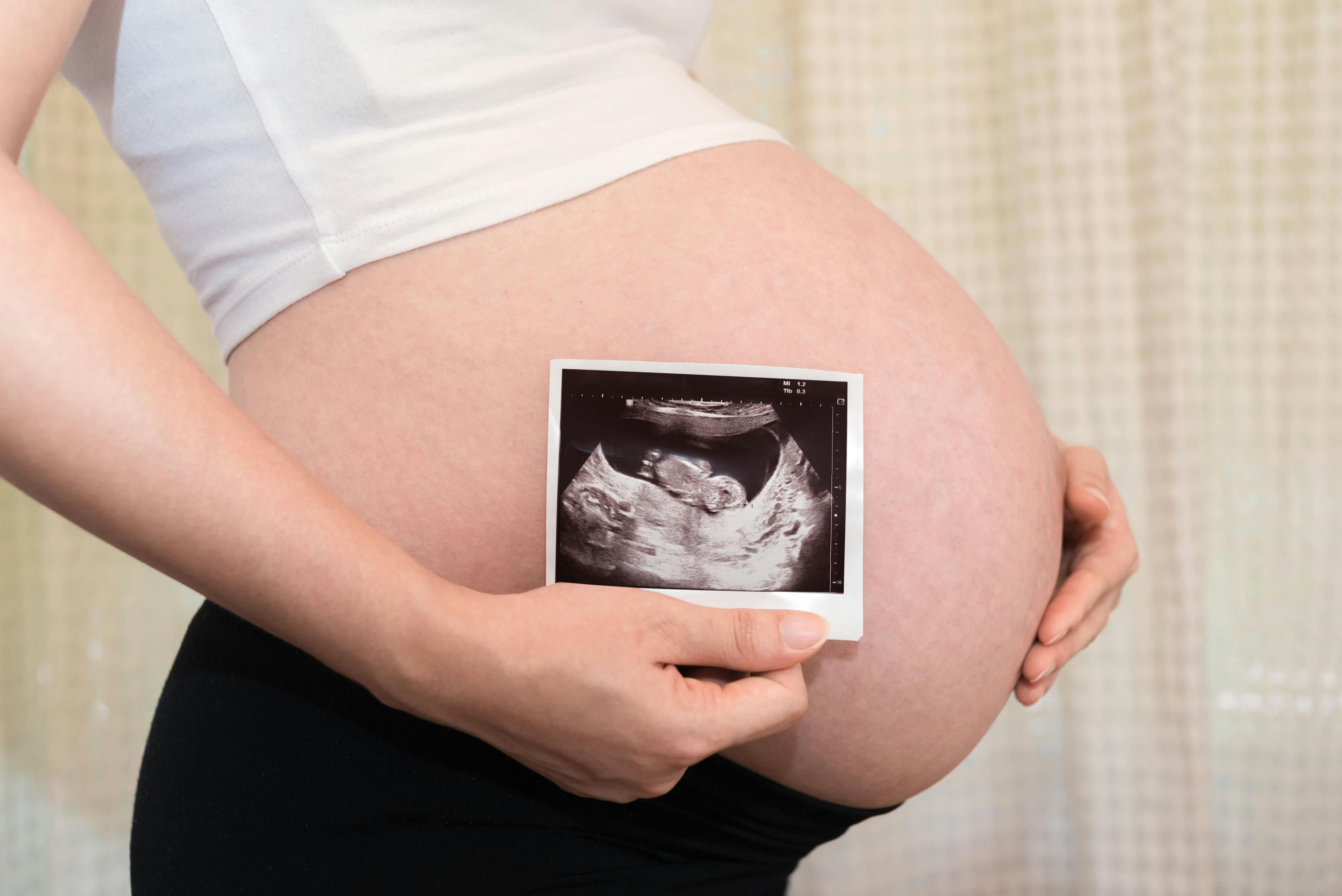 Noninvasive prenatal screening in twin pregnancies