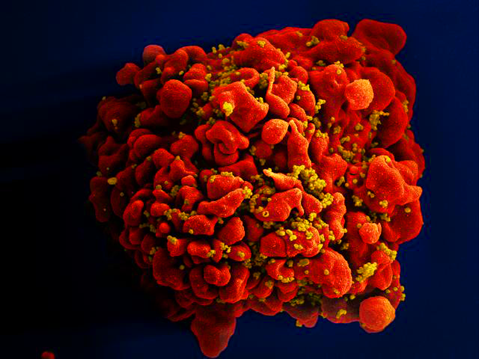 New HIV vaccine strengthens and lengthens immunity