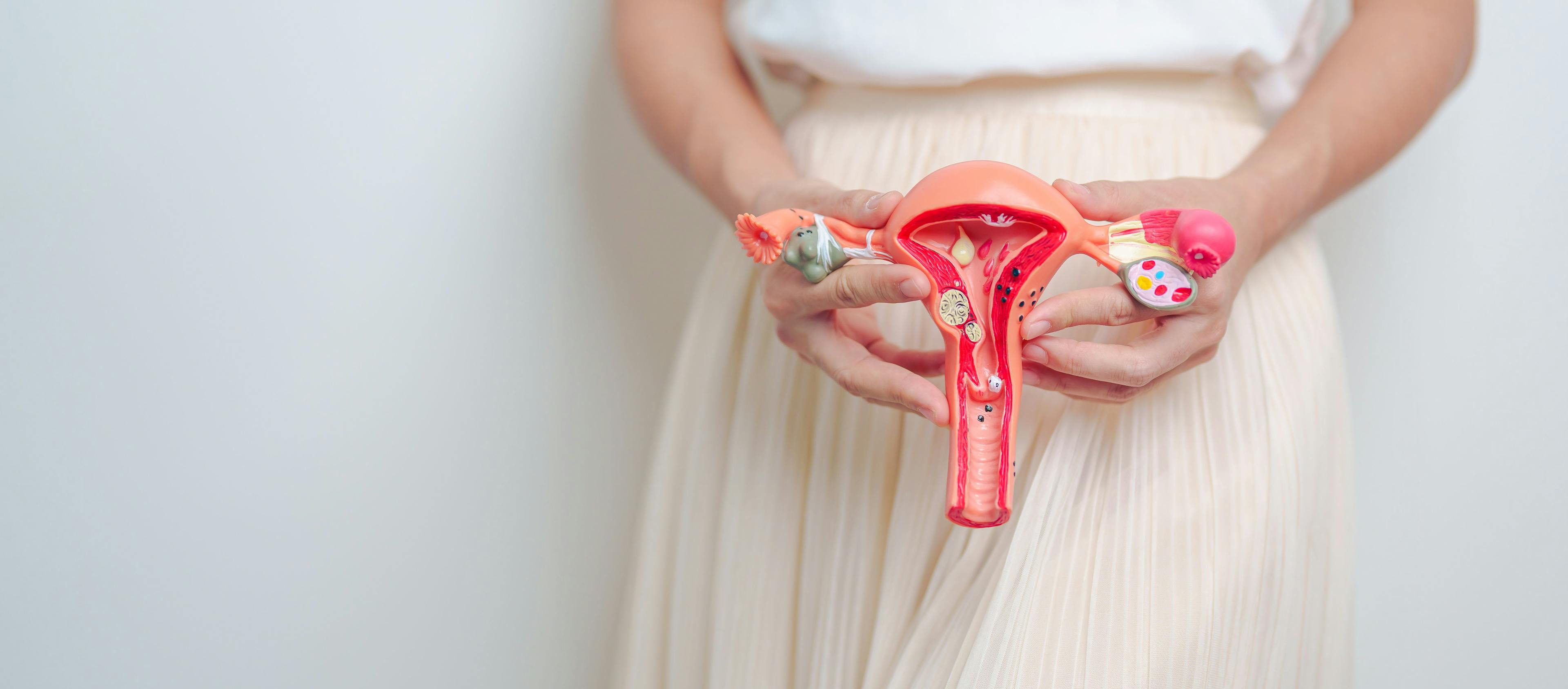 Treating heavy menstrual bleeding: Levonorgestrel system vs combined oral contraceptives | Image Credit: © Jo Panuwat D - © Jo Panuwat D - stock.adobe.com.