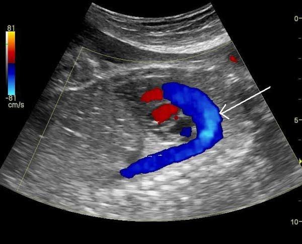Image IQ: Anatomy of the Fetal Heart