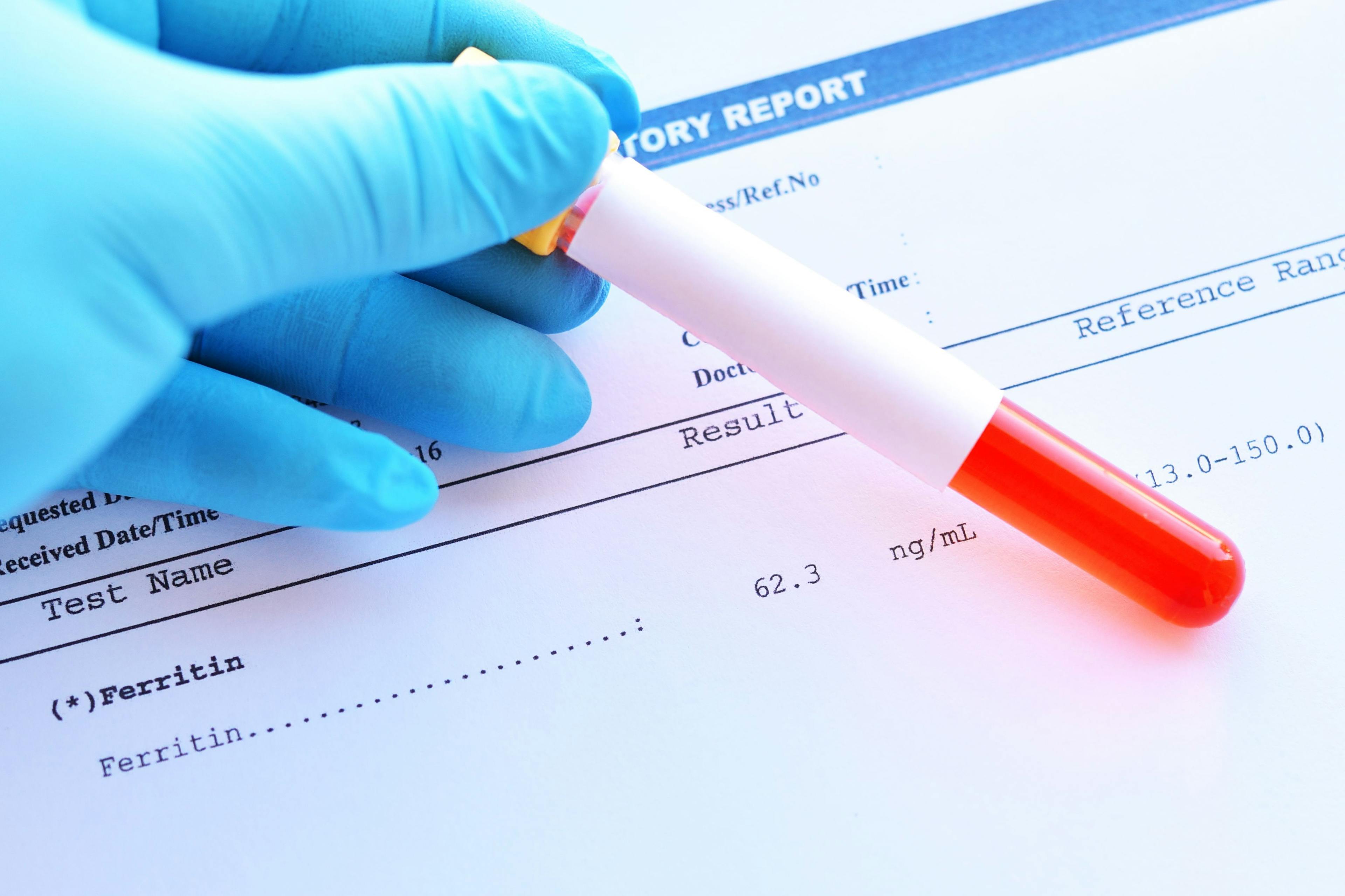 Effect of Ferritin and vitamin D levels in fibroid cases with anemia