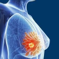 Trastuzumab deruxtecan significantly improves PFS, OS in HER2-low metastatic breast cancer