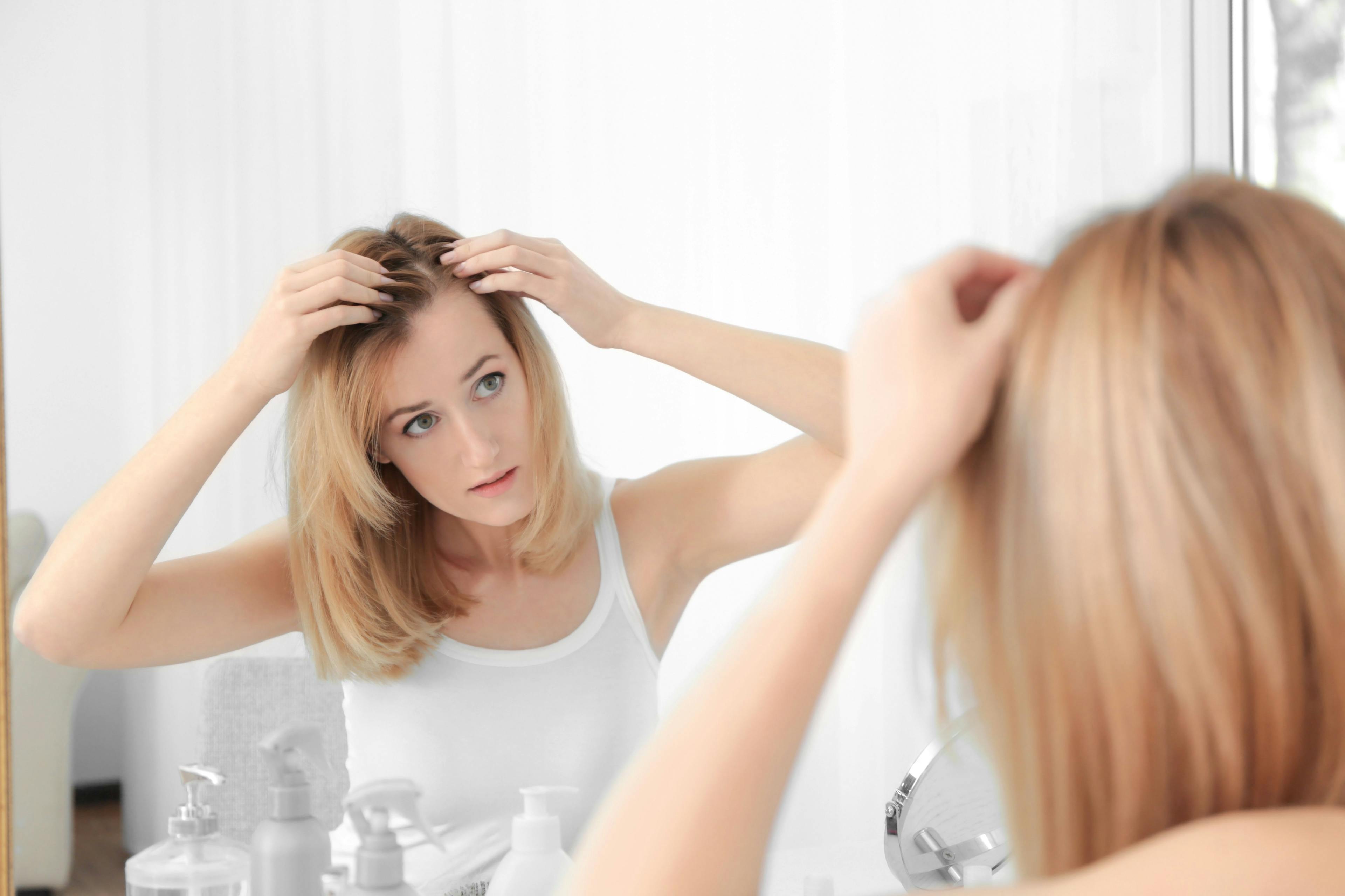 Clinical study shows positive results of nutraceutical supplement to promote hair growth