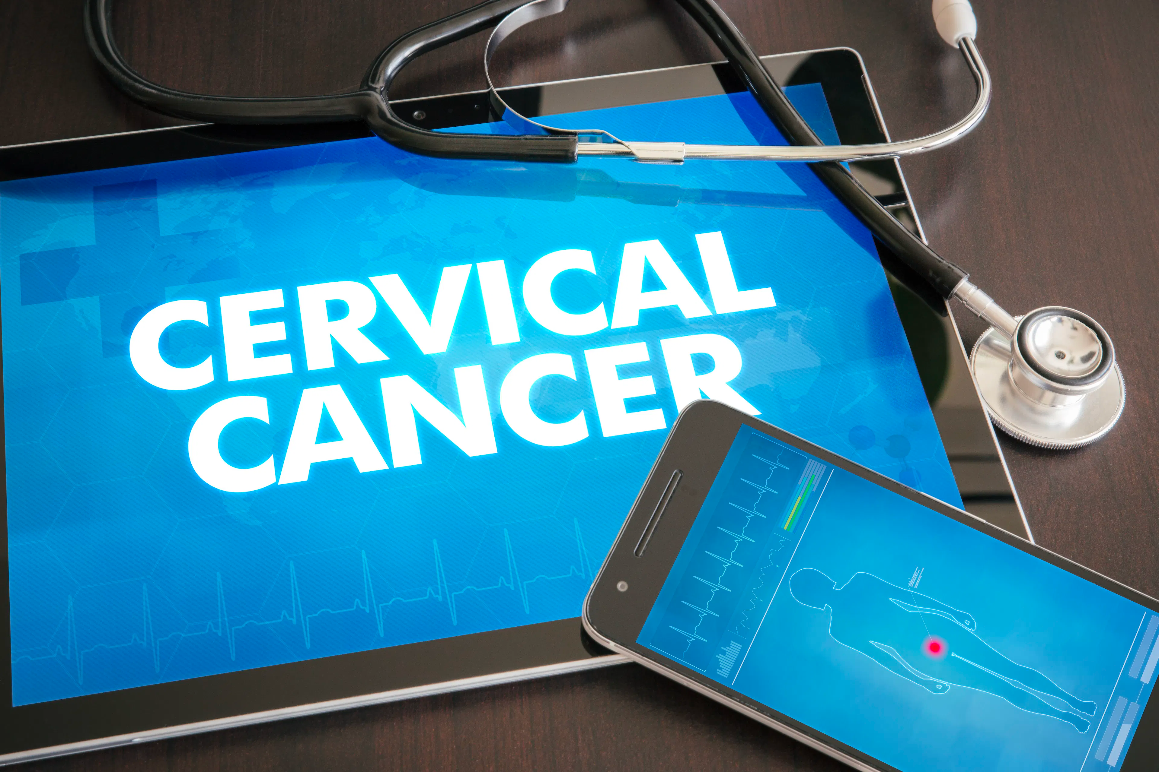LACC trial sparks surge in open abdominal hysterectomy for cervical cancer | Image Credit: © ibreakstock - © ibreakstock - stock.adobe.com.