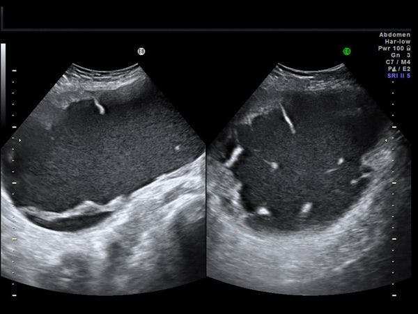 Daily Dx: Pelvis in Middle-Aged Woman