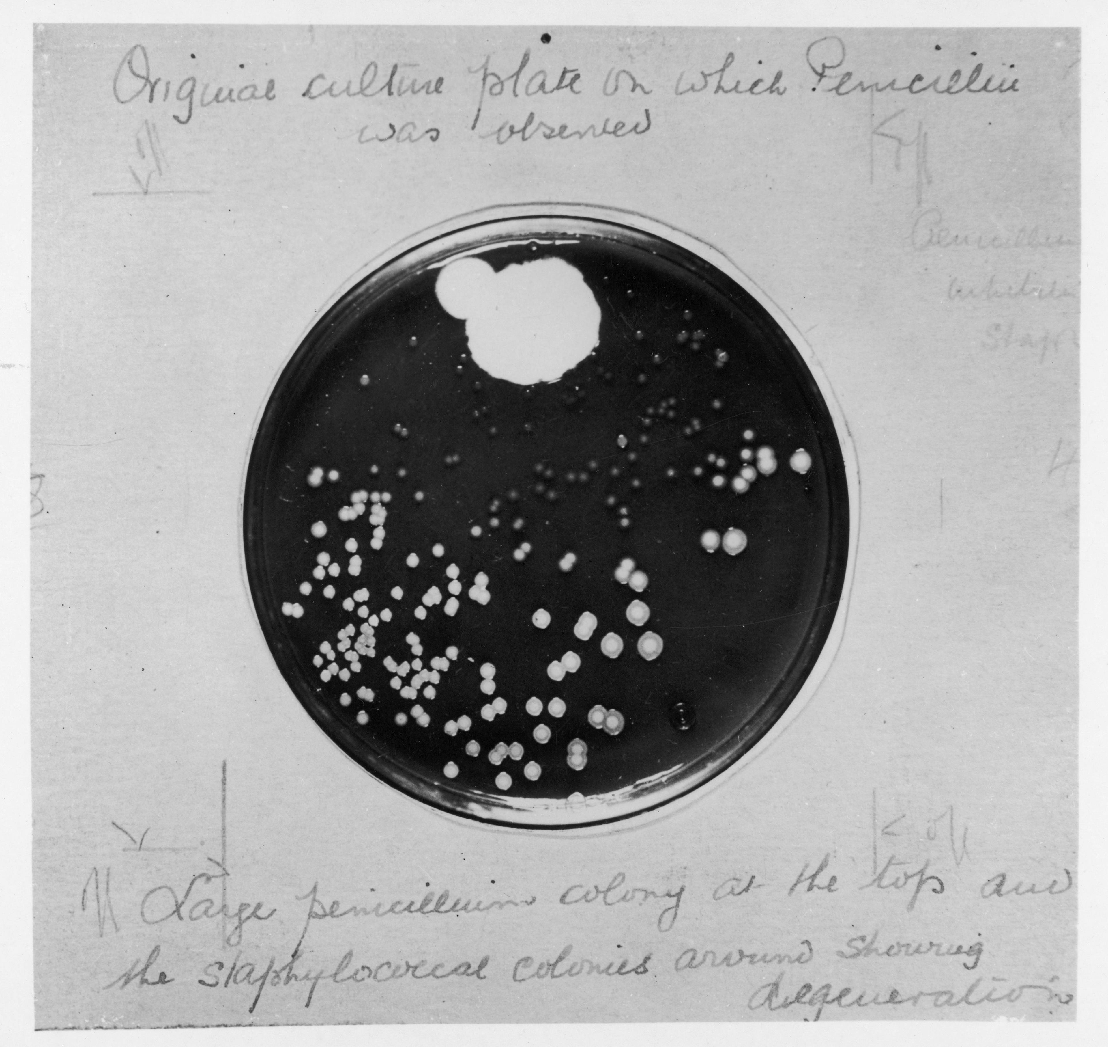 Safely evaluating penicillin allergy with 2-step Graded Oral Challenge | Image Credit: © Archivist - © Archivist - stock.adobe.com.