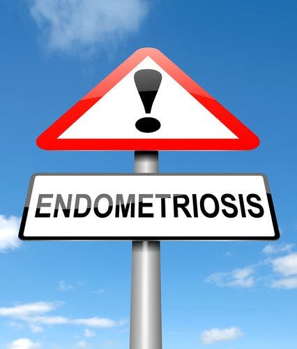 Dietary Recommendations for Endometriosis